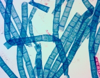Spirogyra small.jpg